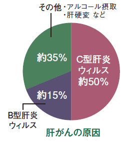 肝がんの原因