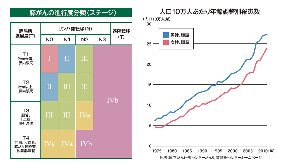 膵がんの進行度分類 / 人口10万人あたり年齢調整別罹患率