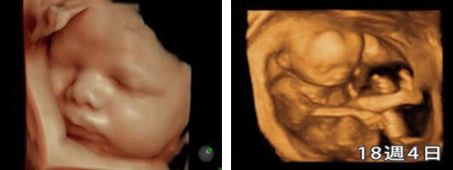 赤ちゃんの動きや表情がくっきり 最新の超音波検査4dエコーを導入 病院からのお知らせ 福井県済生会病院