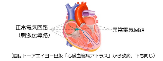 Aレーション