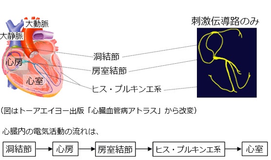 洞不全症候群完全房室ブロック 主な疾患 福井県済生会病院