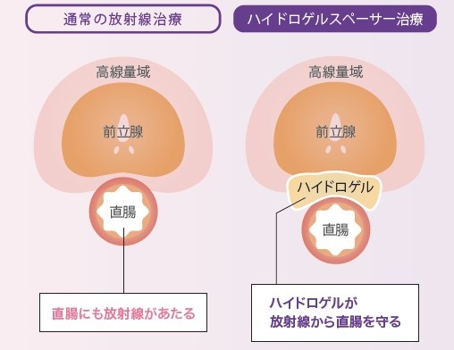 治療中に愛する人をサポートする方法