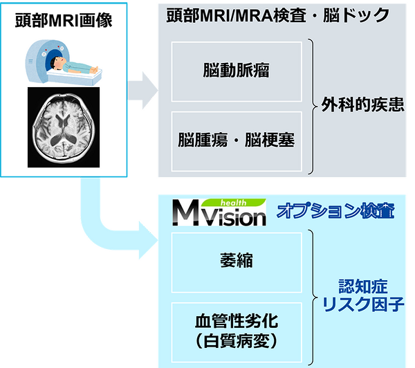 MVision healthの検査フロー