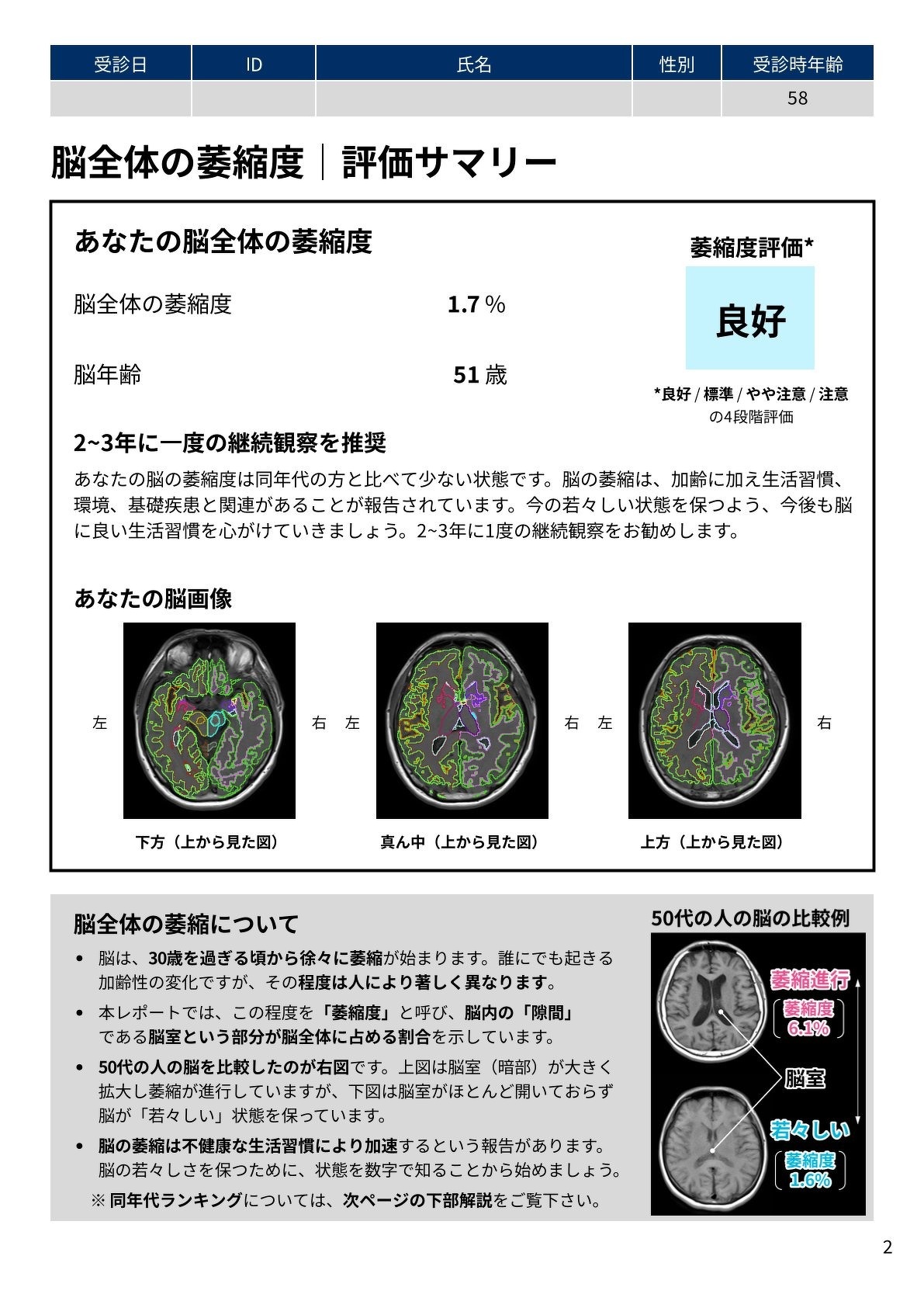 脳全体の萎縮度レポート