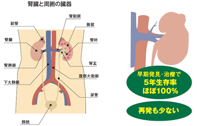 腎臓と周囲の臓器