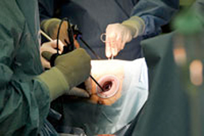 患者さんは横向きの体勢に。胸に開けた穴から器具を入れて手術を行う。