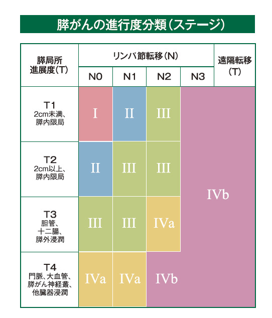 膵がんの進行度分類