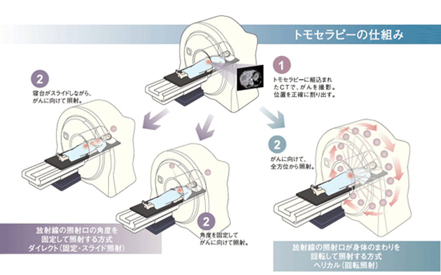 トモセラピーの仕組み