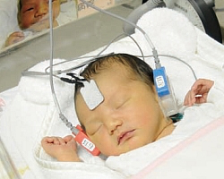 新生児聴覚スクリーニング検査（AABR)
